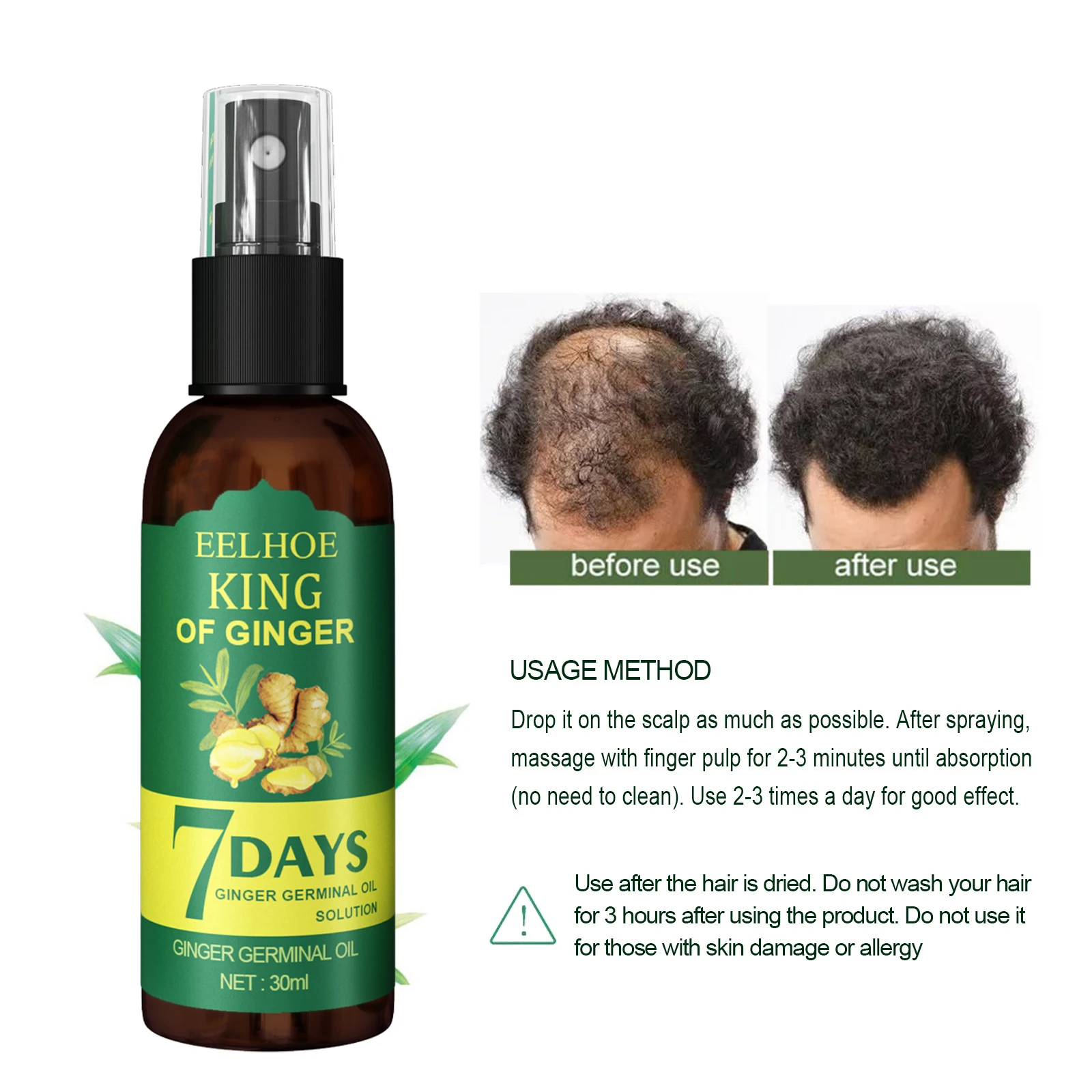 EELHOE Hair Growth Spray 7 Day Ginger Serum Unisex Scalp Damaged Prevent Hair Loss Effective Fast Growth Massage Liquid 50ml