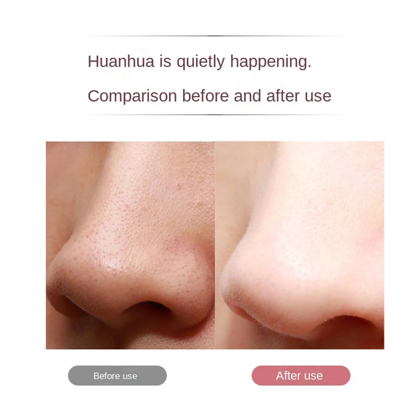 Spatule d'épurateur de peau avec 3 modes, dissolvant de points noirs, nettoyant pour le visage, outil de soin de la peau, vibration, nettoyage du visage, lifting