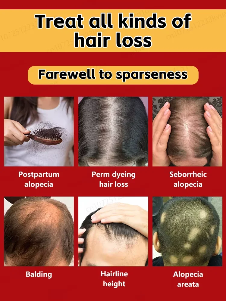 Sem desconforto, ss, taxa de redução de gordura 100% Sem desconforto, 