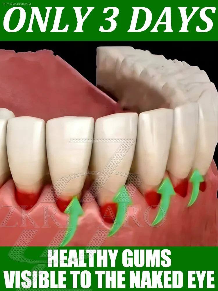 

Rᴇᴘᴀɪʀs ᴏʀᴀʟ ʜᴇᴀʟᴛʜ,reduces tooth sensitivity, and freshens breath.