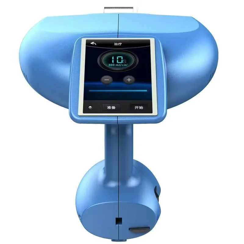 Popular Products Uv Light 308nm Excimer 308nm Excimer Time Card  Treatment Excimer 308nm Vitiligo And Psoriasis