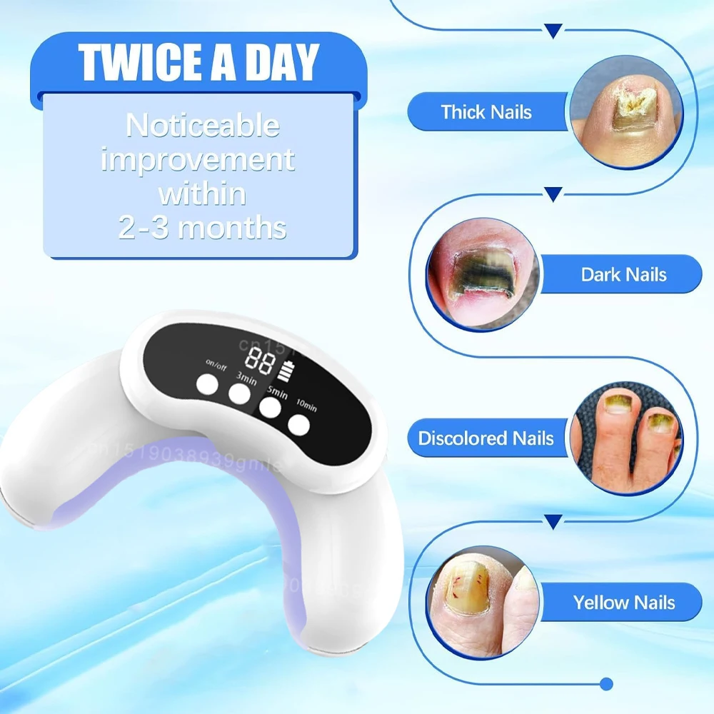 

Nail Fungal Light Device Fungal Discolored Remover Portable Nail Fungal Eradication Device for Thick Toenails and Fingernails