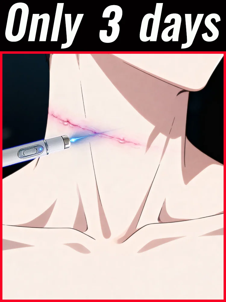 

Обновленная лазерная технология электрого поколения для ремонта гипертрофических шрамов