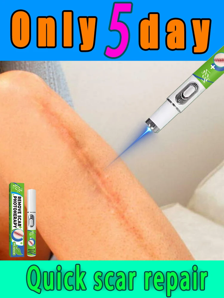 

A sᴀғᴇ ʙʟᴜᴇ ʟɪɢʜᴛ sᴄᴀʀ ʀᴇᴍᴏᴠᴀʟ ʟᴀsᴇʀ ᴘᴇɴ ᴛʜᴀᴛ ᴇʟɪᴍɪɴᴀᴛᴇs sᴄᴀʀs ᴀɴᴅ ᴘʀᴇᴠᴇɴᴛs sᴄᴀʀ ʀᴇᴄᴜʀʀᴇɴᴄᴇ