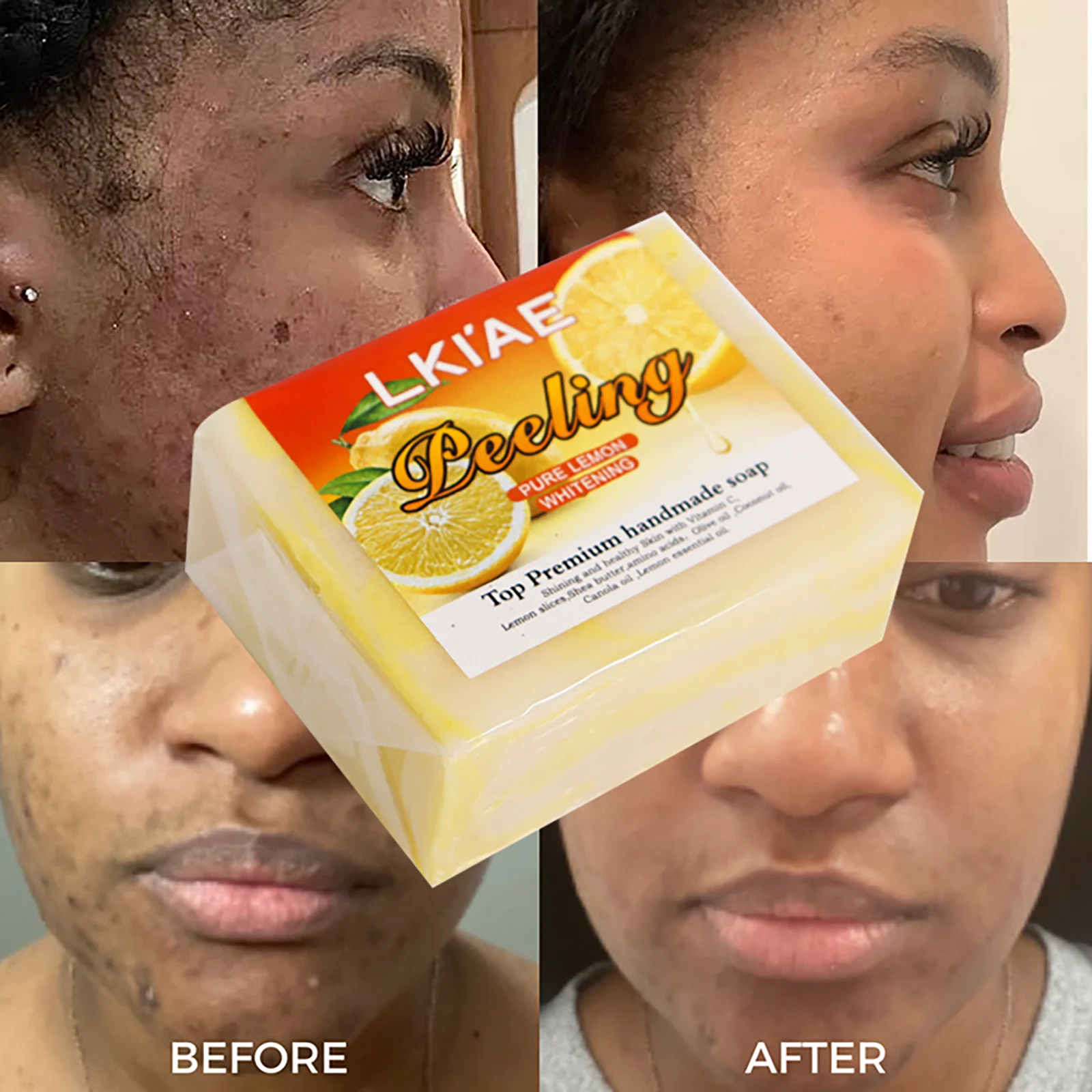 

LKIAE Organic Lemon Cold Processed Soap, Brightening, Moisturizing, With Vitamin C, Kojic Acid, Anti Acne and Dark Spots