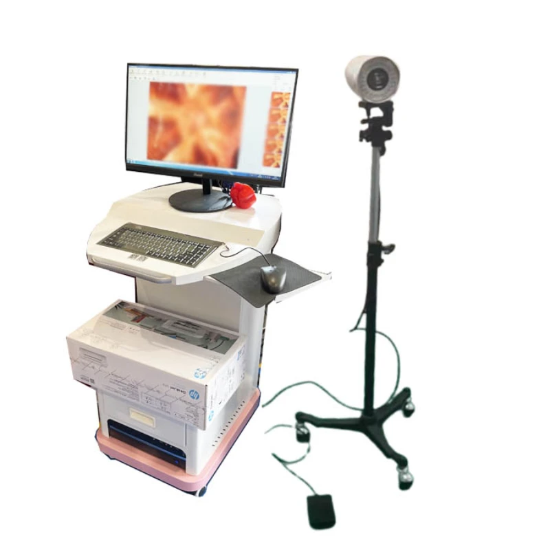 2 million high-definition digital colposcopy medical cervical examination