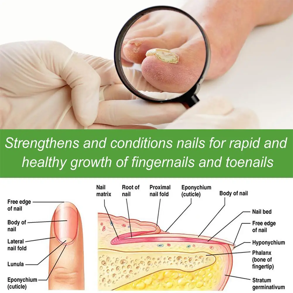 Rodillo de reparación para crecimiento y endurecimiento de uñas, 2 piezas, suavizante, eliminación de uñas, espesamiento, solución nutritiva para iluminar las uñas