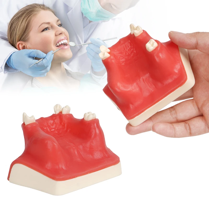 1pc Maxillary Sinus Teeth Model Dental Implant Student Teaching Practice Model Upper Jaw Sinus Lift Implants Restoration Model