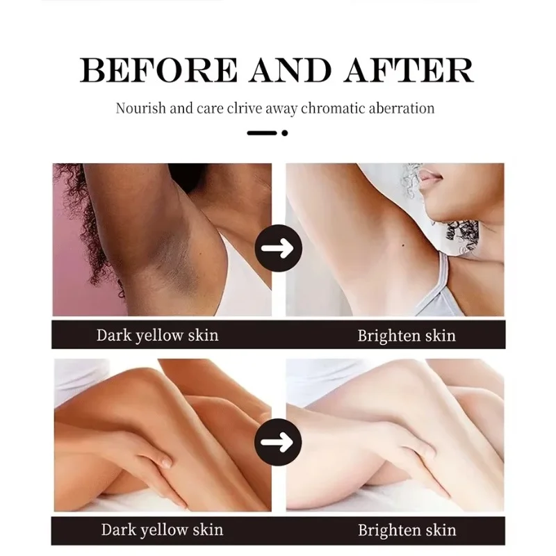 Отбеливающий крем для тела, осветляющий кожу, подмышек, колен, ягодиц, интимные части, отбеливатель внутренней части бедра, интимная зона, удаление меланина, уход