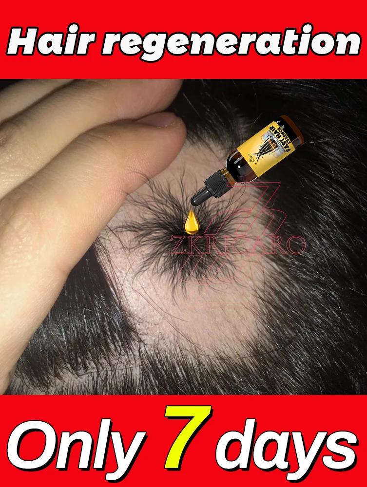 

Равно питает кожу головы, мишени питательные вещества к корням волос, точно укрепляет поры и укоряет рост цикла.