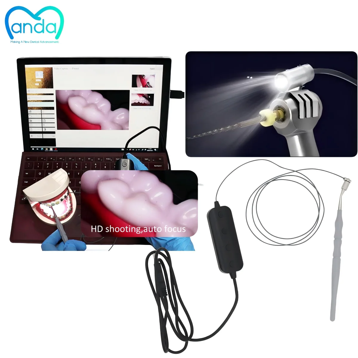 

Portable HD Dental Camera with Foot Control - Adjustable LED Brightness+Windows/Android Sync for Clinics
