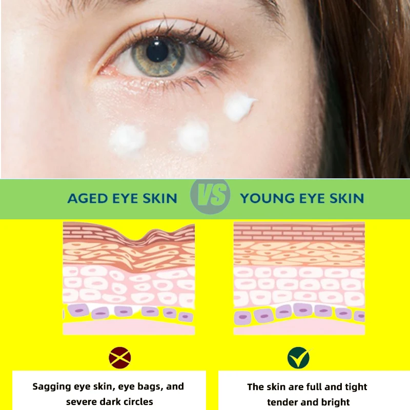 Eye Cream Bags Removal Dark Circles Puffiness Away Work Under Eyes