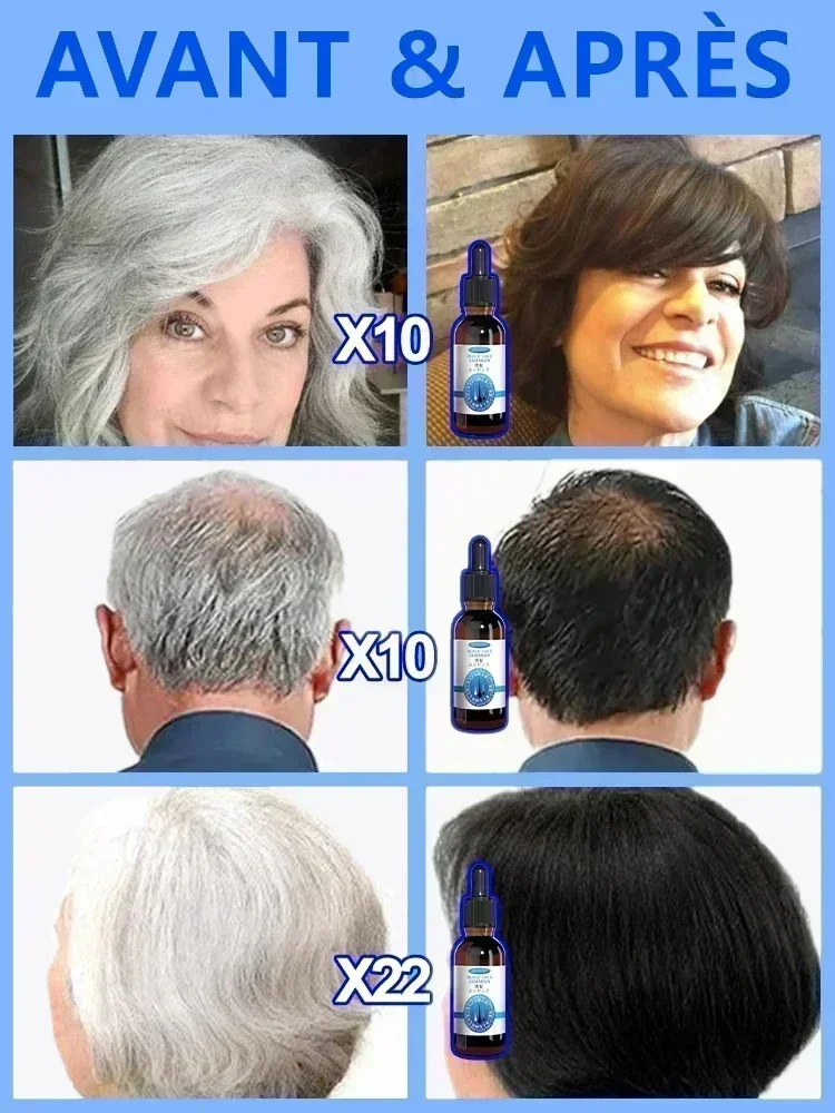 Anti-Grey cabelo soro tratamento, restaurar, impedir o cabelo, nós branco, Ahair em preto, saudável, cor natural