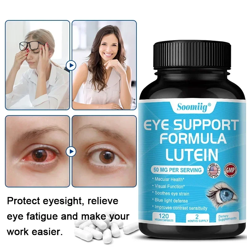 

Eye Lutein Capsules – Support Eye Health, Relieve Fatigue, Macular Blue Light Dry Eye and Vision Health – Lutein Blend