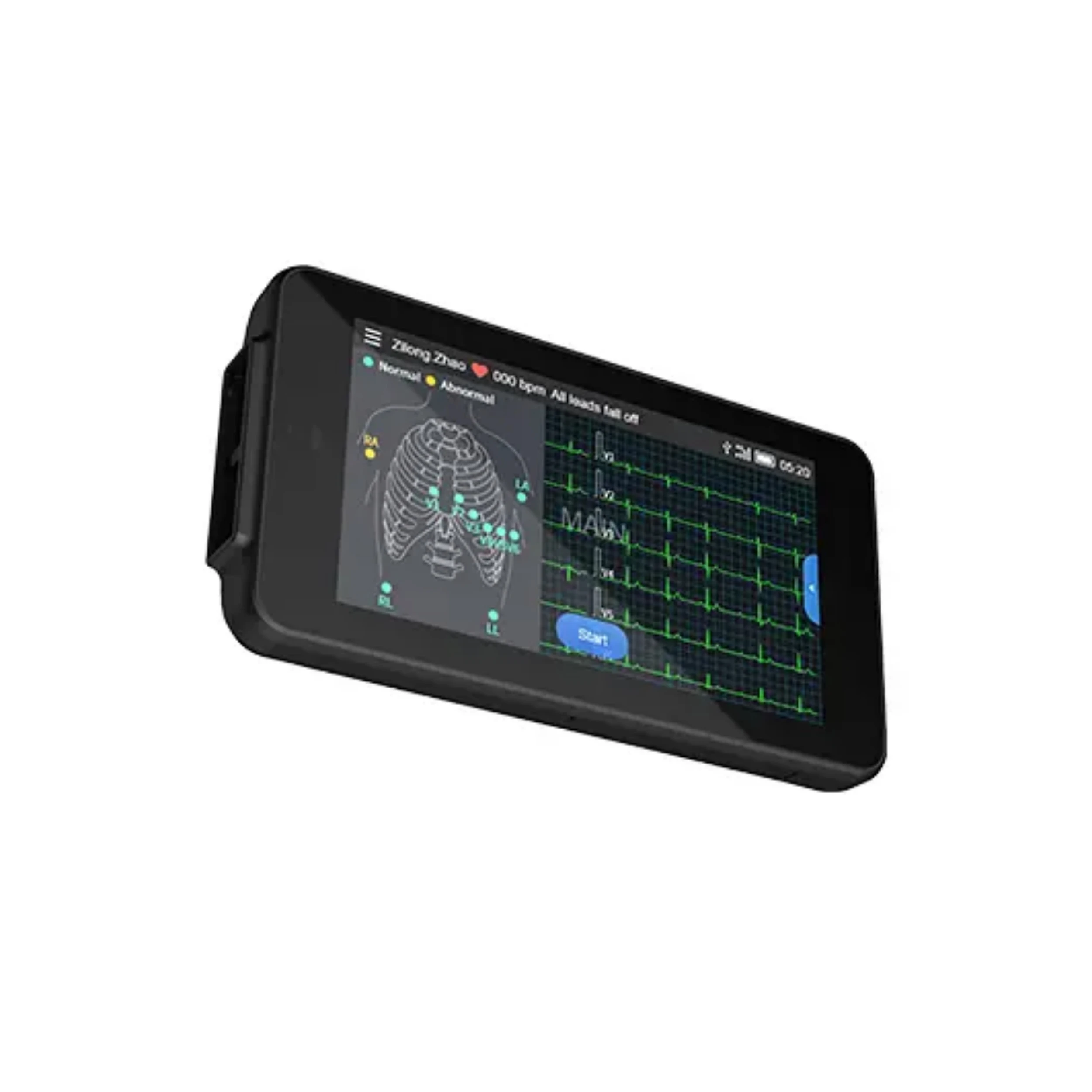 

Best Price LCD Color Touch Screen Portable Design Compact and Lightweight Mini Machine