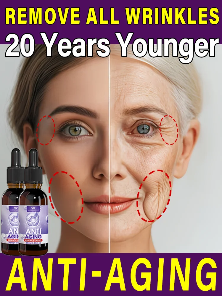 

100% Young