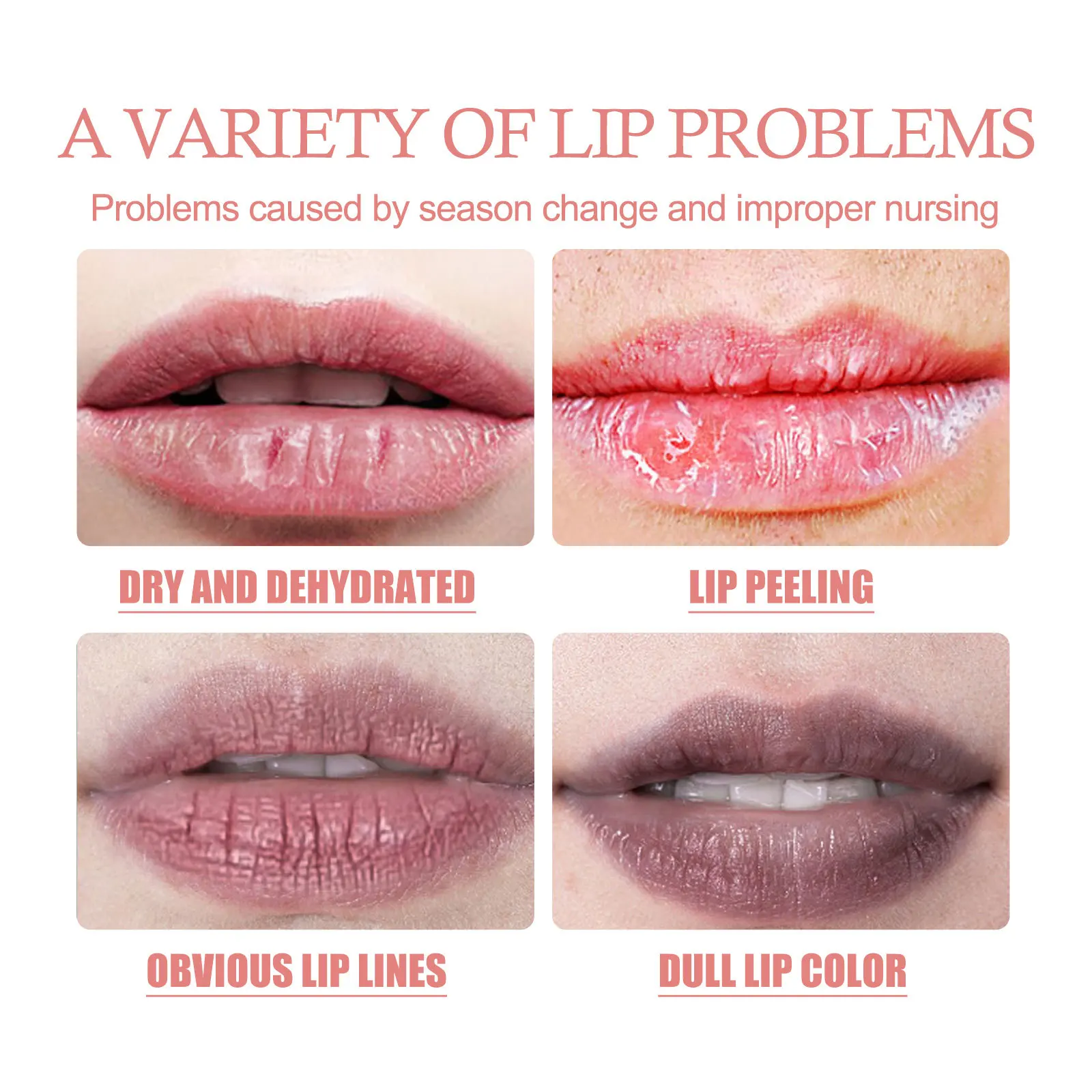 Blase Peeling Lippen Maske Befeuchten Verblassen Linie Erweichen Lip Keratin Dunkelheit Entferner Haut Erleichtern Abgestorbene Haut Lippen Pflege Maske