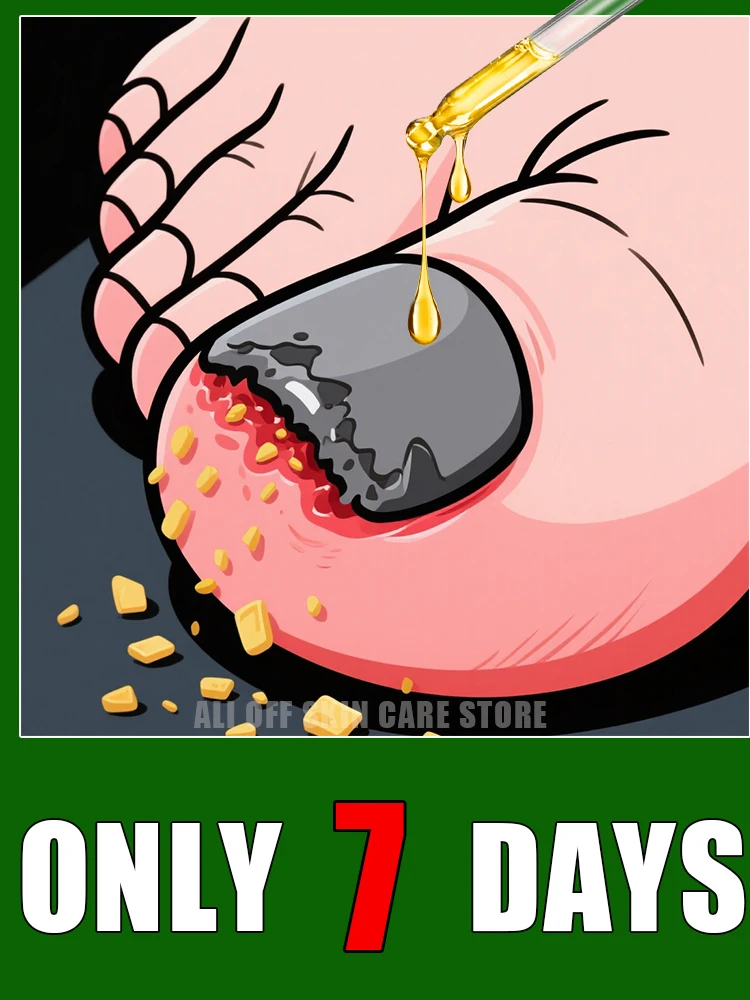 

Qᴜɪᴄᴋʟʏ ᴇʟɪᴍɪɴᴀᴛᴇ ғᴜɴɢᴜs ᴀɴᴅ ʀᴇsᴛᴏʀᴇ ʜᴇᴀʟᴛʜʏ ɴᴀɪʟs