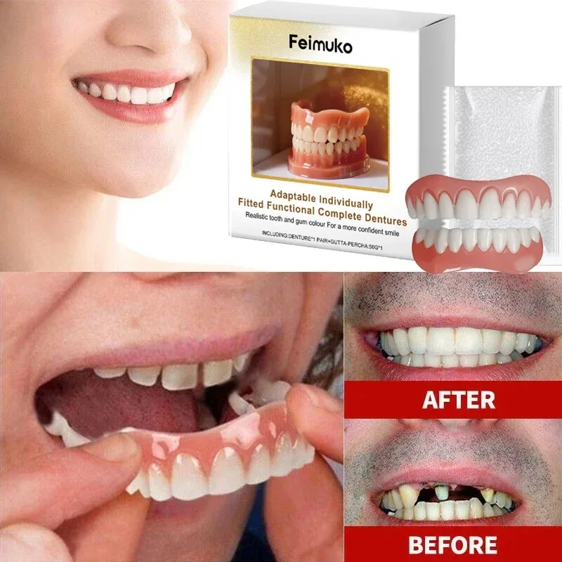 Denture Silicone Kit Comfortable Smiling False Teeth Soft Kit Teeth Upper Lower Set Silicone Liners Soft Denture Kit Easy Use