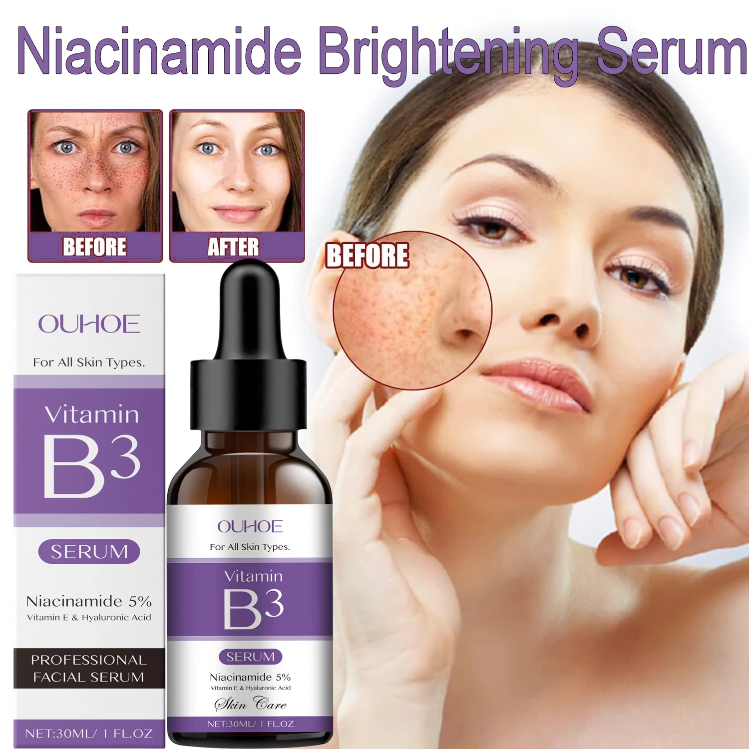 

Корейская сыворотка для лица с ниацинамидом (витамин B3) против морщин, пигментных пятен и темных пятен, корректирующая, придающая сияние, отбеливающая и увлажняющая.