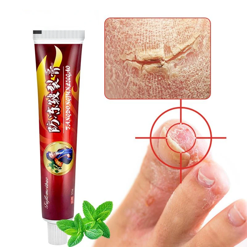 1Pcs Anti-Drying Crack Ointment Hand Foot Heel Cracked Repair Plaster Removal Dead Skin Care Chinese Herbal Medicine Cream S101