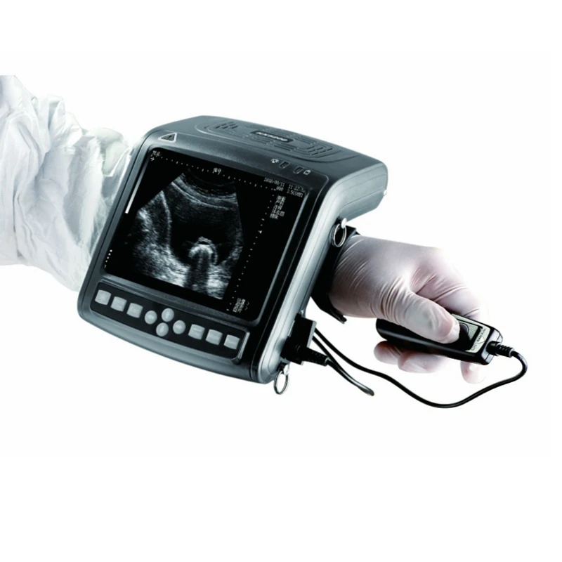 Full digital with different optional probes mobile sonography medical ultrasound instruments veterinary scanner machines