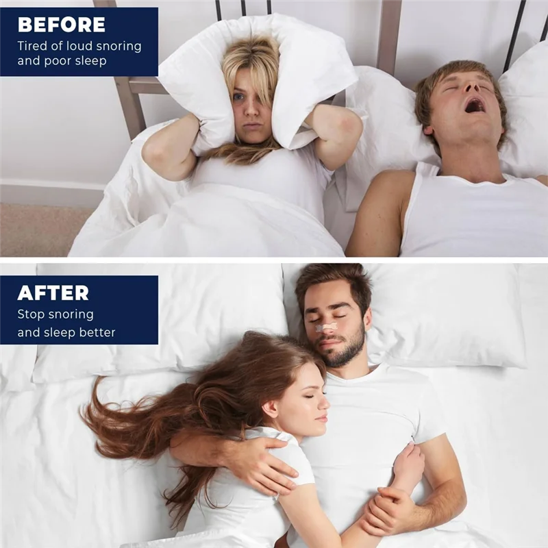 【Flash Sale】 Neusstrips voor snurken Verbeterde luchtstroom Verlicht verstopte neus Extra sterkte Anti-snurkoplossing 30 stuks