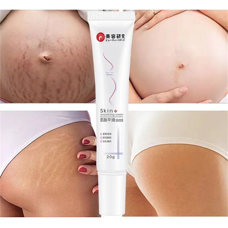 

Stretch Marks Remover Cream Pregnancy Maternity Body New Old Stretch Remove Marks Lifting Firming Increase Elasticity Of Skin