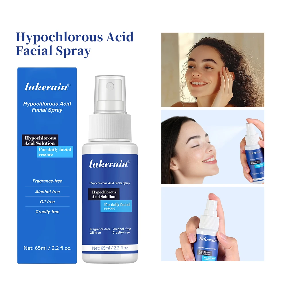 Hypochloorzuur gezichtsspray gebruikt voor elke huid Verminder roodheid, zwelling van acne, kalme roodheid, piercing, nazorg