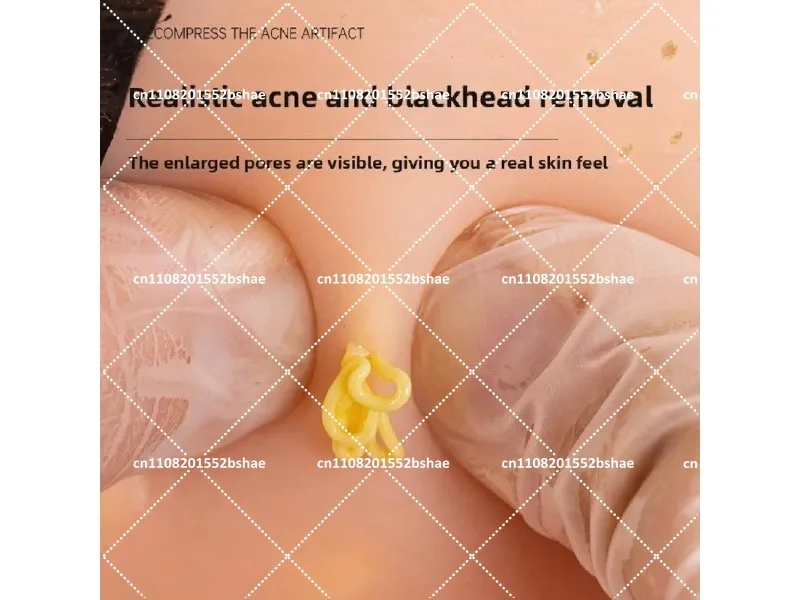 Decompression Toy Acne Squeezing Simulation Big Head Model Strawberry Nose Pimple Popping Anxiety Relief