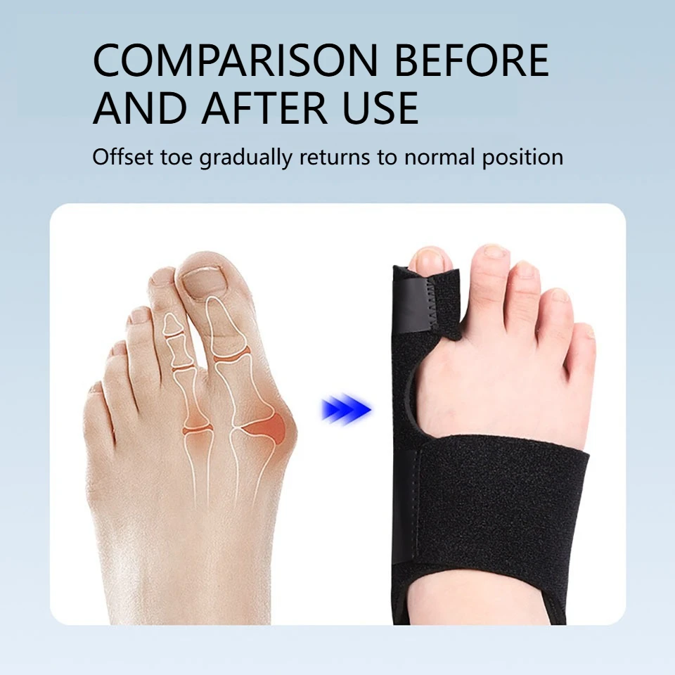 Thumb Protective Cover Big Foot Eversion Corrector Available Day Night Adjustable Hallux Valgus Separate The Bigfoot Bone Unisex