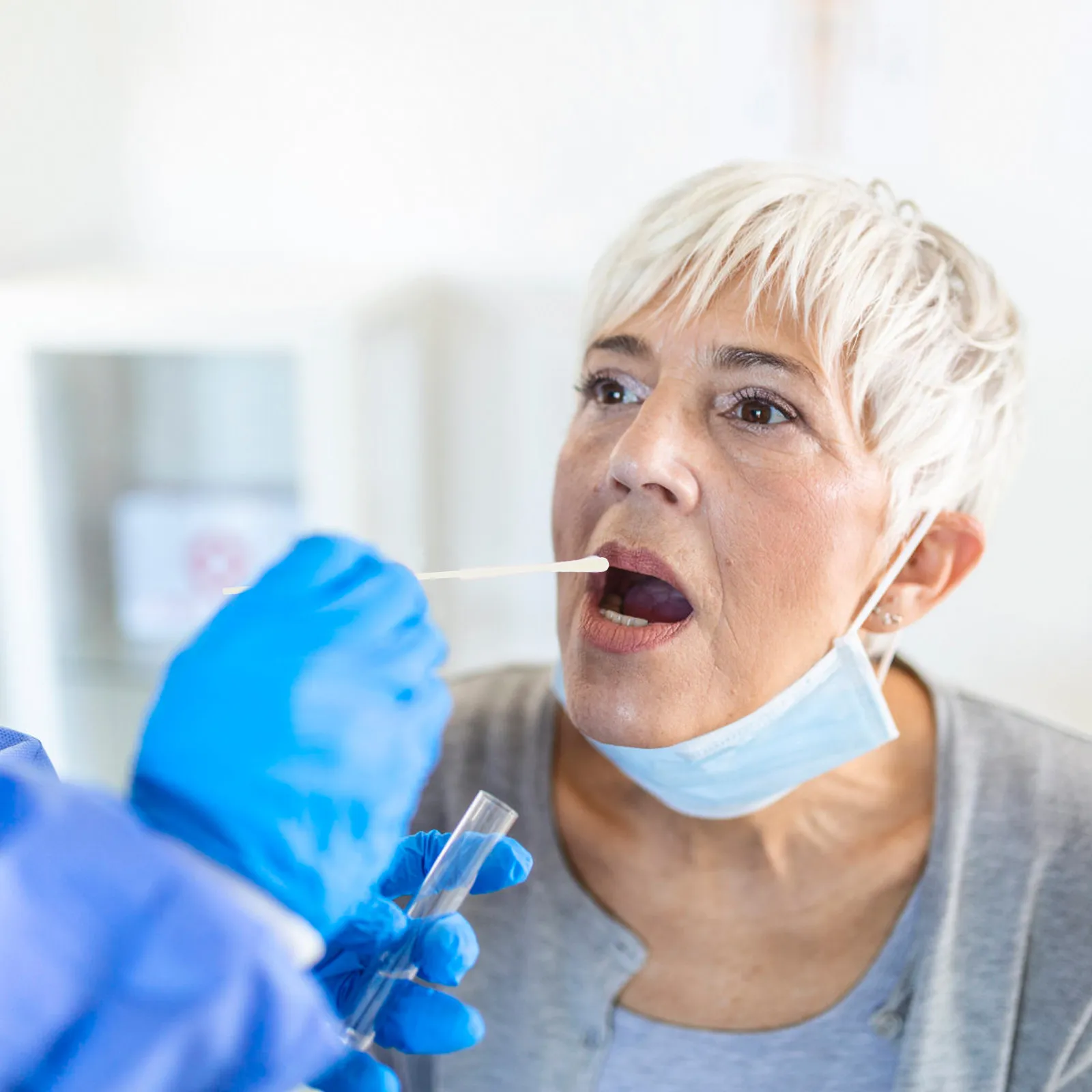 100-unidades-de-hisopos-orales-flocados-para-muestreo-de-garganta-de-pacientes-hisopos-nasofaringeos-de-mango-largo-para-diagnostico-hospitalario-y-recoleccion-de-muestras