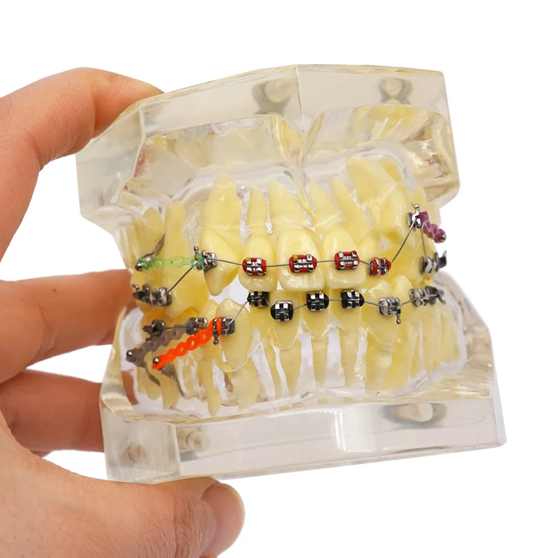 Dental Orthodontics Teeth Model with Brackets Buccal Tubes Chain Dentist Teaching Training Malocclusion Orthodontic Teeth Model