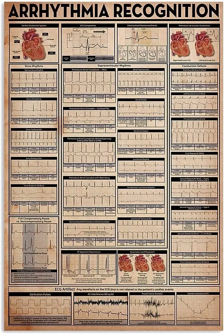 Youpinnong Cardiology Knowledge Metal Signs Arrhythmia Recognition Infographic Posters Ecg Wall Hanging Signs Home Club Office W