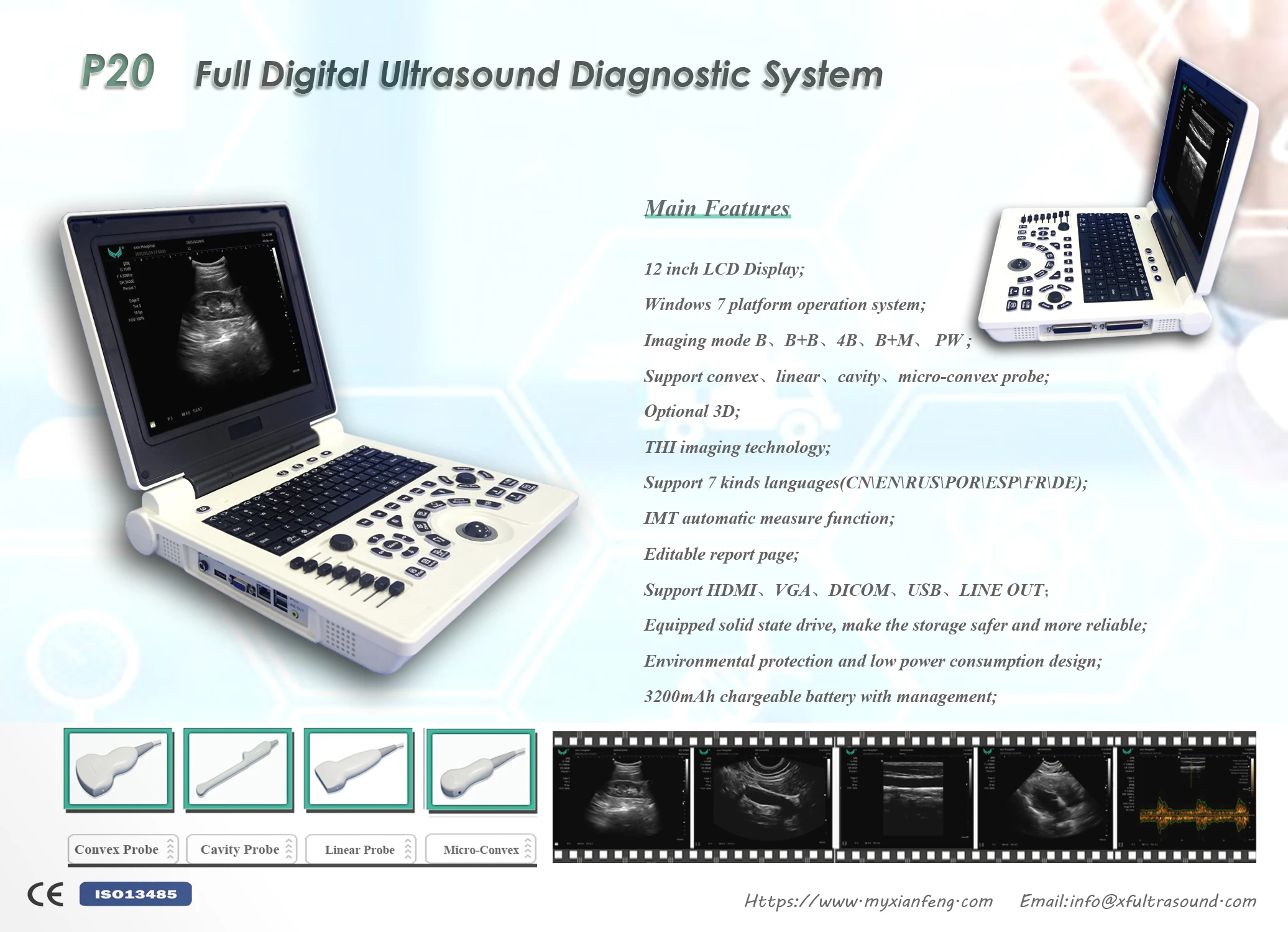 Cheap BW ultrasound scanner with THI PW 3D for human or Veterinary software optional