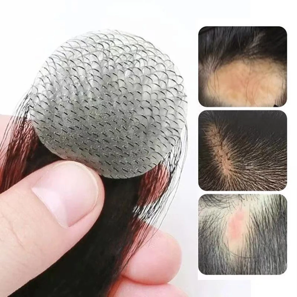 Round Human Hair Extensions Hairloss on Temples Bald Spot Toupee Scar Human Hair Replacement Hairline for Men and Women