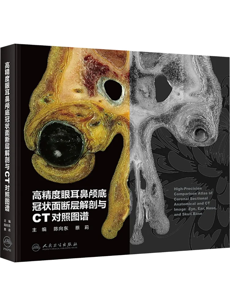 Book-Winshare High Precision Anatomical Atlas Of the Eye Ear Nose Skull Base and Coronal Plane With Ct Comparison
