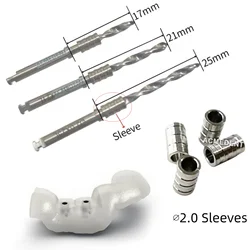 Dental Pilot Anchor Drill Pin Fixing Nail Implant Guide Teeth Digital Jaw 2.0mm