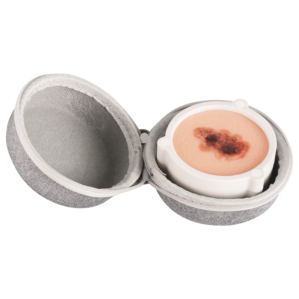Silicone Skin Cancer Anatomical Model 9 * 9 * 6cm for Scientific Education