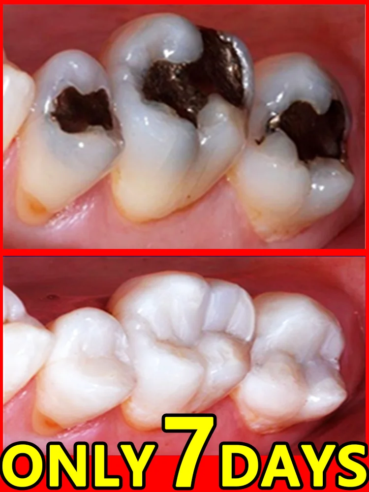 

Зубная паста для отбеливания зубов — частота отправки 99% — отбеливает зубы с результатами вы любви