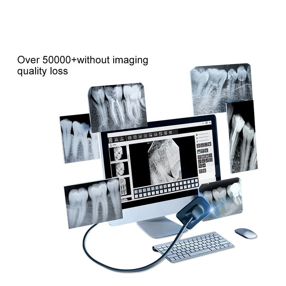 DENTAL X-Ray Sensor Intraoral Digital System HD Image DynImage Dentistry Tools Compatible with Different X-ray Generators