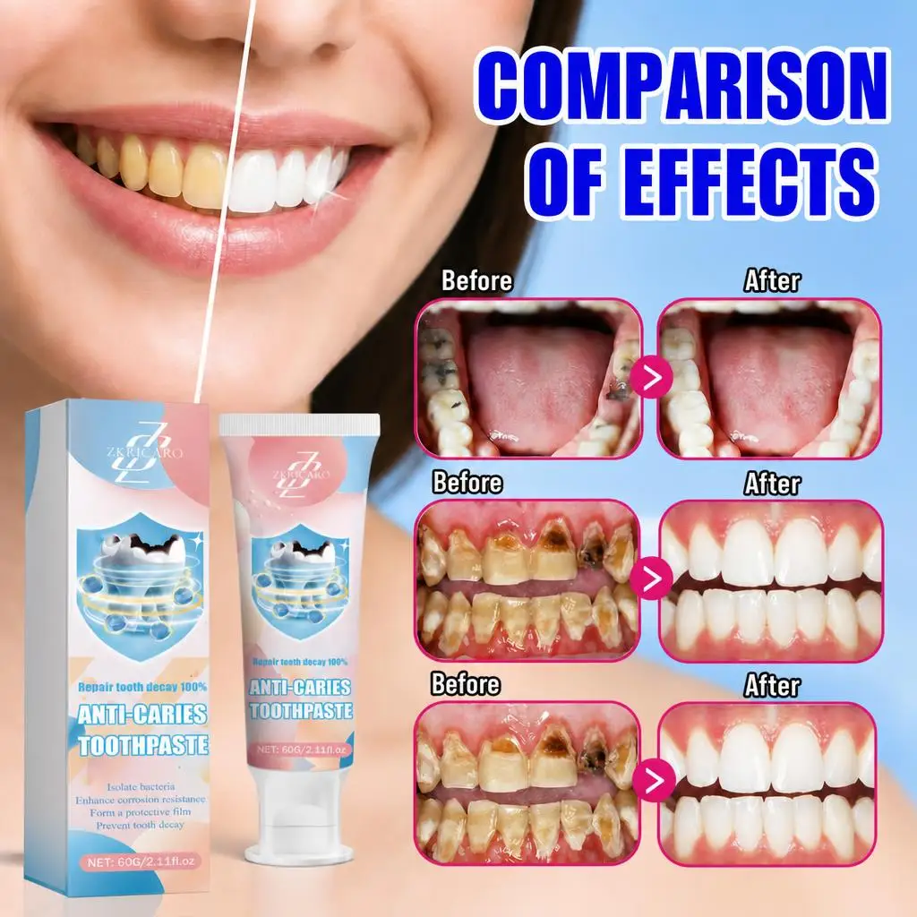 Advanced Cavity Protection Toothpaste – Gentle Daily Care for Sensitive Teeth, Strengthens Enamel, Fights Plaque & Tartar, Fresh Breath & Clean Smile, Prevents Tooth Decay Naturally, Family Friendly Formula