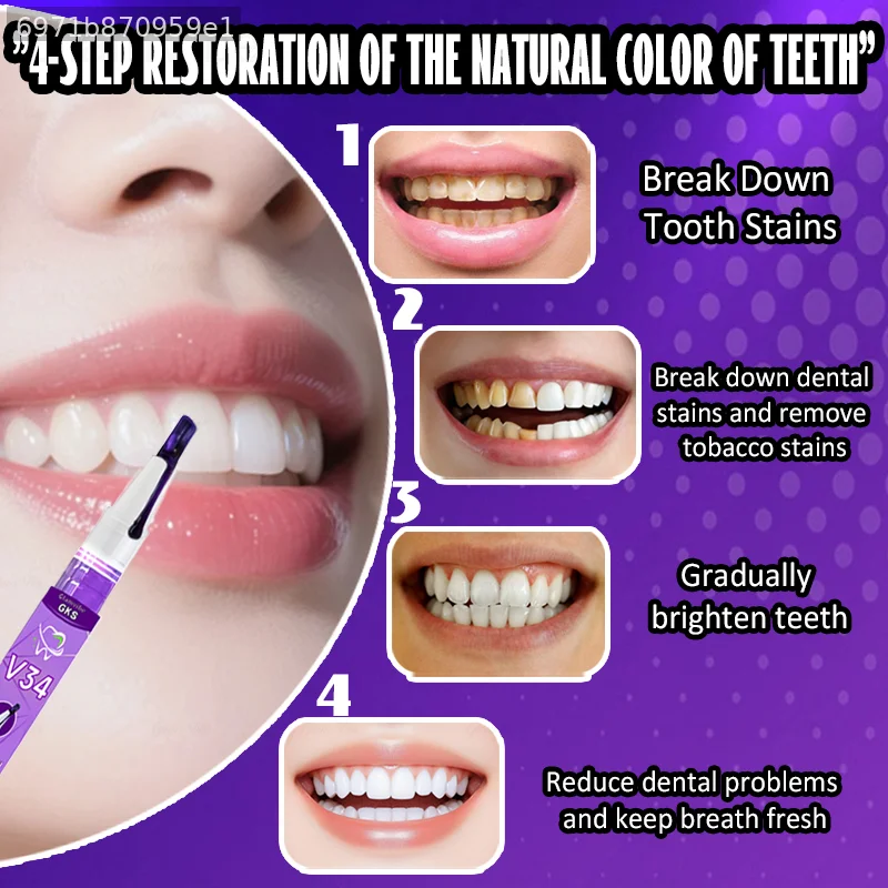 POZOAMIS Penna sbiancante viol - Teeth Whitening Pen recensione e prezzo