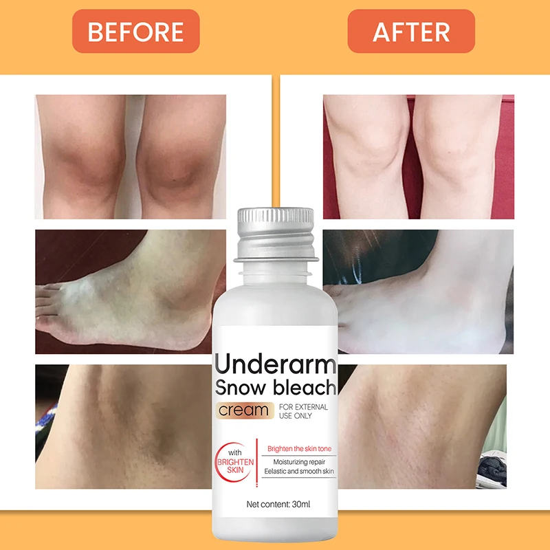 Body Whitening Bleach Cream Brighten Underarm Elbow Knees Joint Removal Intimate Parts Dark Spots Melanin Snow Bleach Cream 30ml