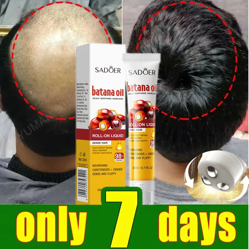 

Batana Oils Fast Hair Growth Serum Anti-loss Hair Regrowth Essential Oil Roller Scalp Treatment Hair Care Products for Men Women