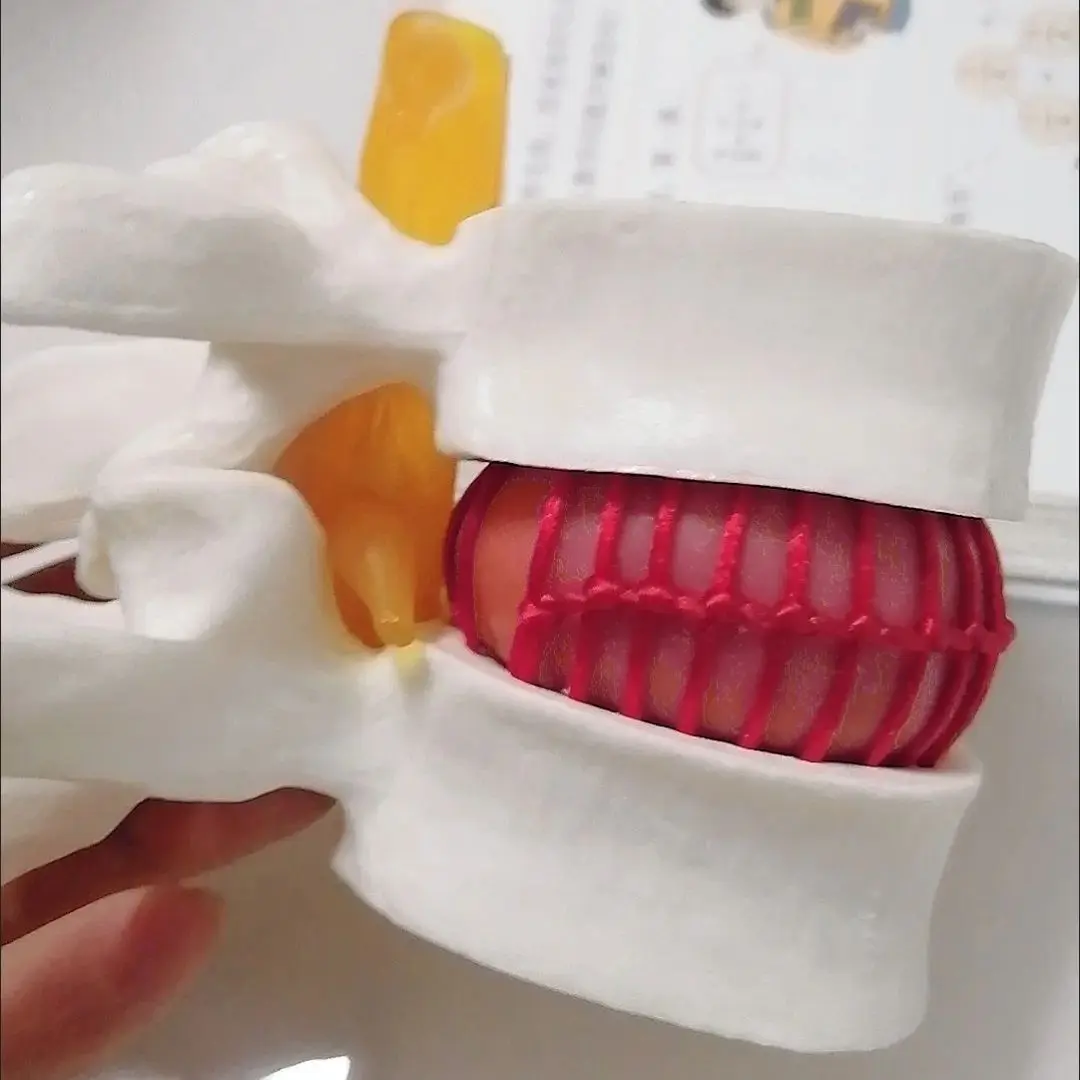 Human Anatomy Skeleton Spine Lumbar Disc Herniation Teaching Model Brain Skull Traumatic Pistol School Supplies Medical Instrume