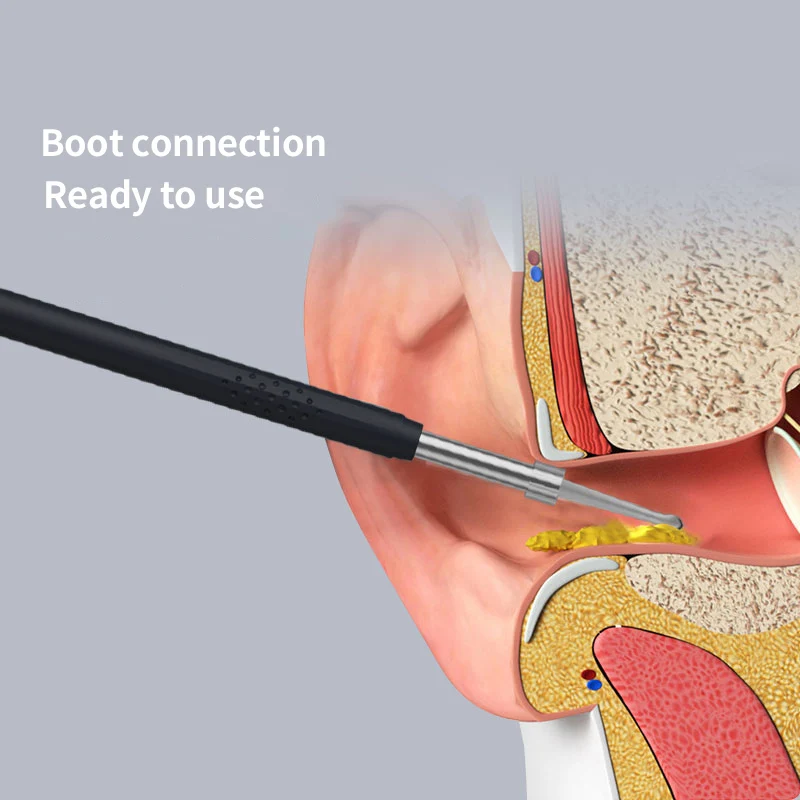 Smart Visual Medico Otoscopio Ear Cleaner Ear Endoscope Earpick Camera Ear Wax Remover Tool Ear Picker Ear Stick IPX6