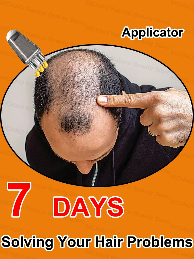 Improve your hair thinning problem