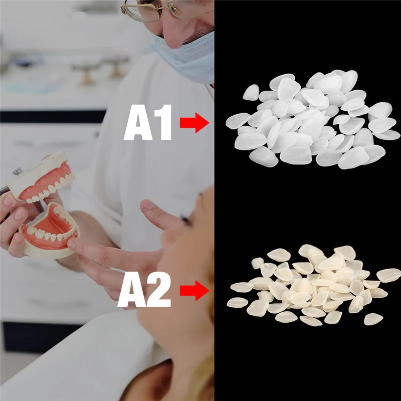 500 sztuk forniry na zęby żywica tymczasowa korona Ultra cienka naprawa zestawy wybielające dentysta sztuczny ząb pielęgnacja jamy ustnej materiały czyszczące