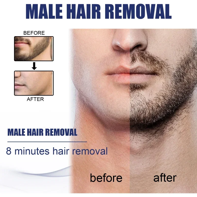 Best Professional Men Beard Hair Removal Cream Permanent Hair Growth Removal Inhibitor Spray Gentle Beard Depilatory Care Cream